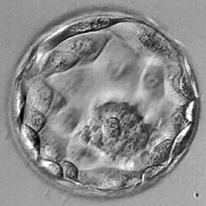 Coltura embrionale in vitro per 13 giorni
