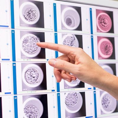IGIN incorpora Embryoscope+ e Intelligenza Artificiale per la migliore selezione embrionaria