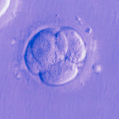 Come vengono selezionati gli embrioni per il trasferimento?